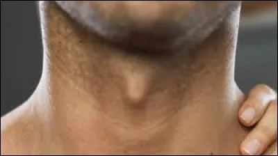 De quoi la pomme d'Adam est-elle constituée ?