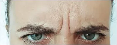 Langue française : Quel animal est associé aux rides situées entre les sourcils ?