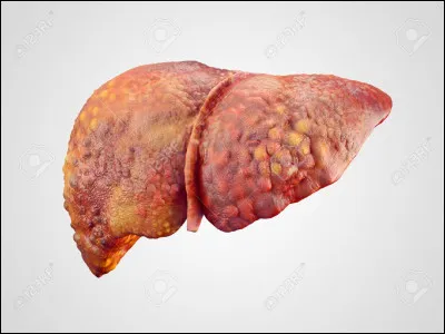 Est-ce que l'asperge est bonne pour le foie ?