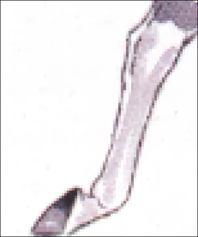 Quel est le nom de cette marque blanche sur les membres ?