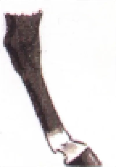 Quel est le nom de cette marque blanche sur les membres ?