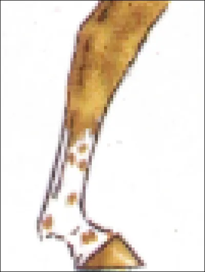 Quel est le nom de cette marque blanche sur les membres ?