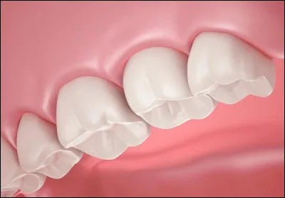 Combien de racines ont les dents molaires supérieures ?