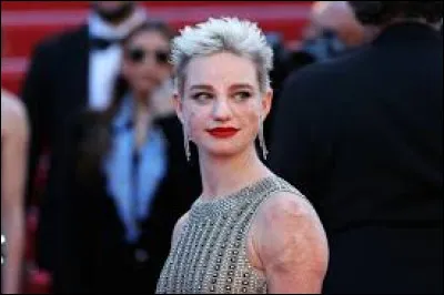 Quel est son surnom dans les médias ?