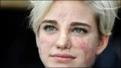 Lors de quels Jeux paralympiques se distingue-t-elle avec son premier titre paralympique ?