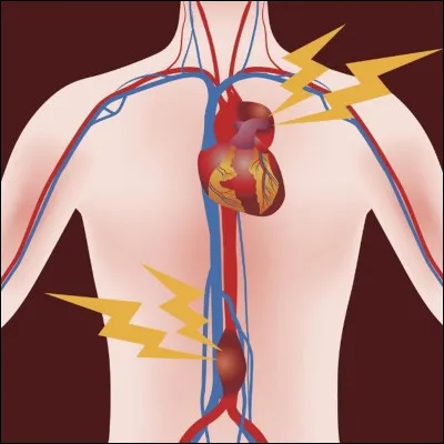 L'aorte est la plus grande artère du corps.