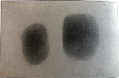 Quel est l'intérêt de ce tracé, réalisé à l'aide d'un pneumodographe ?