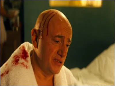 Qu'est-ce qui le blesse ainsi à la tête ?