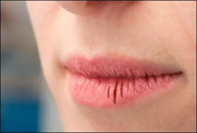 Quelle lettre complète le pays dont la capitale est Athènes, et nous fait donc obtenir l'état des lèvres sur l'image ?