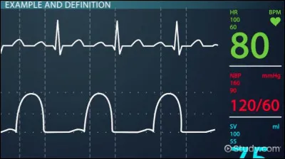 Tombé du ciel, marcher au soleil, je prends le large, on avance à l'infini.