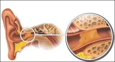 Un bouchon d'oreille est généralement constitué...