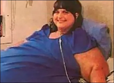 Combien pesait l'Américaine Carol Ann Yager, lorsqu'elle fut hospitalisée en 1993 ?