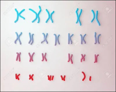 La trisomie 21, est une anomalie qui est liée au chromosome 21.