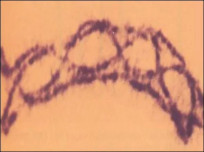 Durant le brassage intrachromosomique, il se produit parfois des crossing-over. 
Que signifie le terme "crossing-over" ?