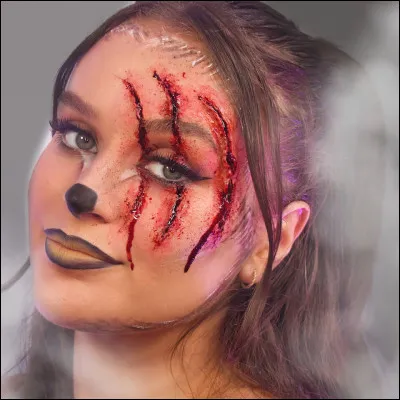 As-tu une malformation ou une blessure qui te différencie beaucoup des autres ?