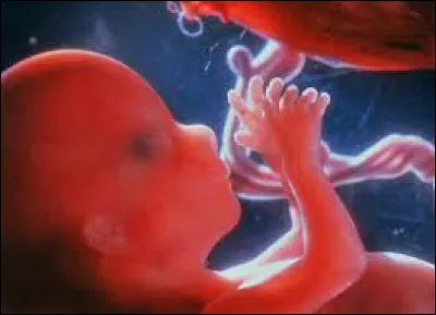 Les jumeaux monozygotes peuvent-ils être de sexe différent ?