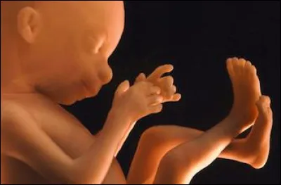 Qu'est-ce que le syndrome du jumeau fantôme ?