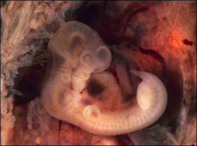 Les jumeaux monozygotes partagent-ils le même placenta ?