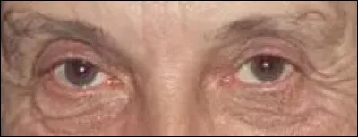 À quelle émission de télévision vous font penser ces yeux-là ?