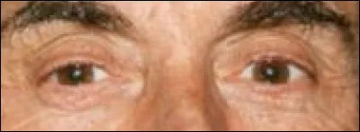 À quel programme de télévision pouvez-vous rattacher ce regard ?