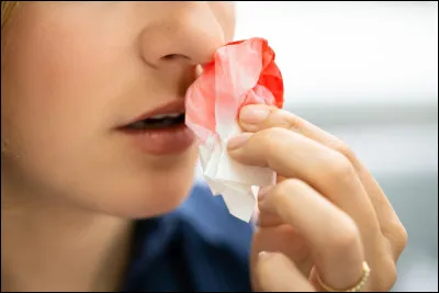 Veuillez traduire : Saigner : infinitif