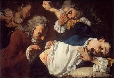 Quelle opération Claudius Amyand pratique-t-il pour la première fois en 1735 en Angleterre ?