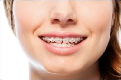 As-tu un appareil dentaire ?