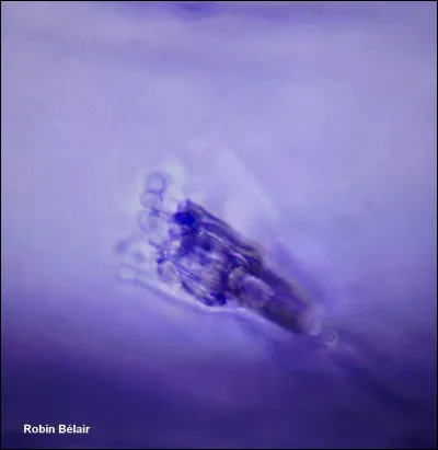 En microscopie, vous observez une structure fongique présentant des conidies en chaînes produites à l'extrémité de conidiophores ramifiés en forme de pinceau. À quel genre de champignon cette structure appartient-elle ?