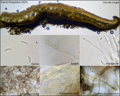 Si vous voyez des asques contenant des ascospores dans un ascocarpe, vous pouvez conclure qu'il s'agit d'un ascomycète. L'absence de ces structures oriente vers un autre groupe de champignons.
Est-ce vrai ?