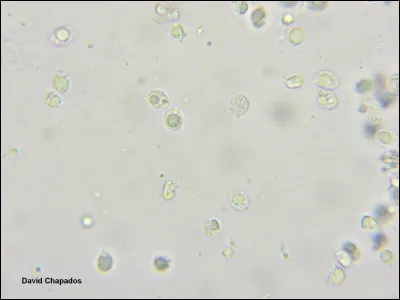 En microscopie, vous observez des spores lisses, unicellulaires et en forme de goutte d'eau. À quel groupe de champignons ces spores sont-elles typiquement associées ?