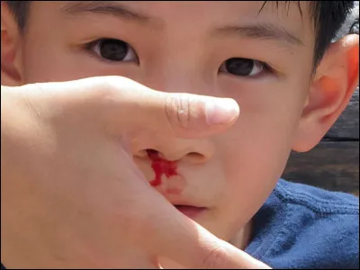 La vue du sang te dérange-t-elle ou non ?