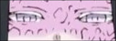 Et ces yeux malades ?