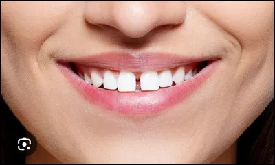 As-tu les dents du bonheur ? (C'est un espace entre les dents.)