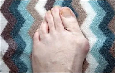 Quelle hécatombe nous conte l'ami Georges Brassens : "Au marché de Brive-la-Gaillarde / --- / Quelques douzaines de gaillardes / Se crêpaient un jour le chignon.
À quel propos ?