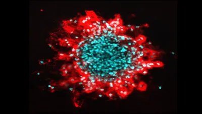 Quelle partie de latome contient les protons et les neutrons ?