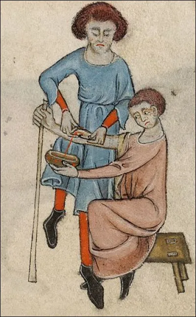 Quelle pratique ancienne consistait à saigner les patients pour les guérir ?