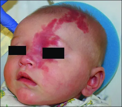 Quel acteur, imitateur, producteur, incarne L&eacute;o Matt&eacute;&iuml;, dans la s&eacute;rie "L&eacute;o Matt&eacute;&iuml;, brigade des mineurs" ?