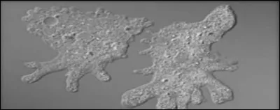 Quel type de morphologie de protiste représente cette photo ?