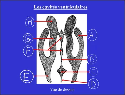 Quelle lettre correspond au ventricule V3 ?