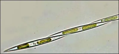 Complétez : ''La Pseudonitzschia...