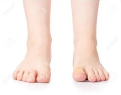 Comment la banquette côtière des pays froids est-elle parfois appelée ?