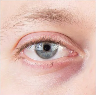 As-tu des cernes ? (Pas gonflés)