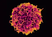 Quiz Quiz sur le cancer
