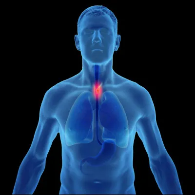 Quel est le cancer le plus courant chez l'homme ?