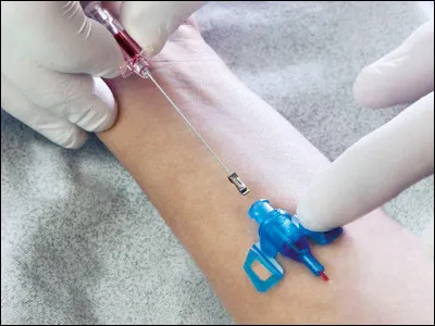 Régulièrement, à chaque fois que je suis hospitalisé, on m'insère dans le bras un tube mince et flexible. Que dois-je en penser ?