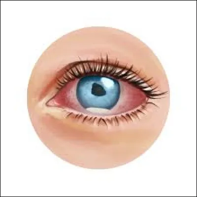 De quel Alter vient l'attaque Le Doigt dans l’œil jusqu’au coude ?