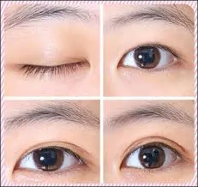 As-tu une double paupière ?