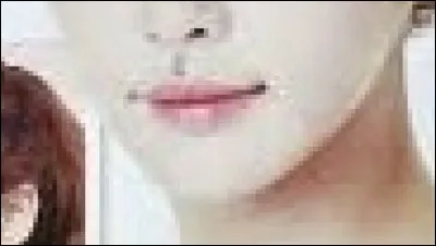 As-tu la mâchoire en forme de V ?