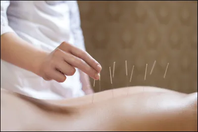 De quel pays est originaire l'acupuncture, pratique qui se sert d'aiguilles le plus souvent ?
