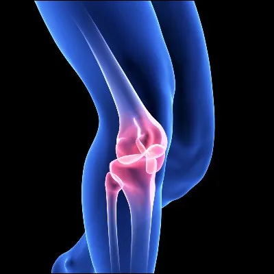 Quelle maladie est due à une dégénérescence du cartilage sans infection ni inflammation ?